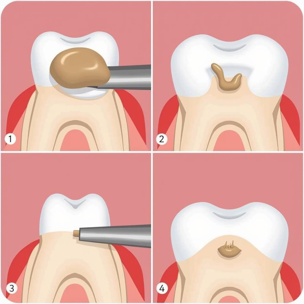 Quy Trình Trám Răng Thẩm Mỹ